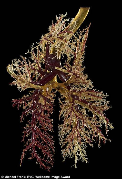 Các mẫu vật sau khi giải phẫu sẽ được ngâm trong dung dịch formalin, bảo tồn cấu trúc phức tạp của nó một cách chi tiết đáng kinh ngạc. Trong ảnh là buồng phổi của một con bò.