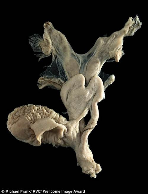 Xem thêm một số hình ảnh khác trong bộ sưu tập của Michael. Trong ảnh là buồng dạ dày của một con dê.