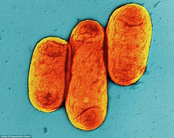 Vi khuẩn là một trong những hình thức sống cơ bản nhất và lâu đời nhất của sự sống trên Trái đất. Những sinh vật nhỏ bé đó lại có “quyền năng” cai trị thế giới từ 3,5 tỷ năm trước và khiến nhân loại kinh hãi bởi có thể gây ra một loạt các căn bệnh chết người.