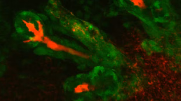 Đại học Khoa học Tokyo đã nuôi cấy thành công tuyến sản xuất nước mắt và nước bọt trong phòng nghiên cứu nhằm giúp đỡ người có bệnh khô mắt và miệng mãn tính vào năm 2013. Tuyến nước bọt và tuyến lệ mới có thể kết nối với dây thần kinh và ống dẫn, tiết ra nước mắt và nước bọt.