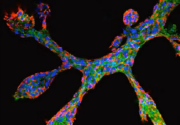 Các nhà nghiên cứu của Trung tâm nghiên cứu sức khỏe và môi trường Helmholtz tại Đức đã nuôi cấy thành công tuyến vú thu nhỏ khi đang nỗ lực nghiên cứu sự phát triển ung thư vú.