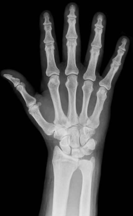 Nước chiếm 31% trong xương của con người. Đây là sự thực gây kinh ngạc cho nhiều người