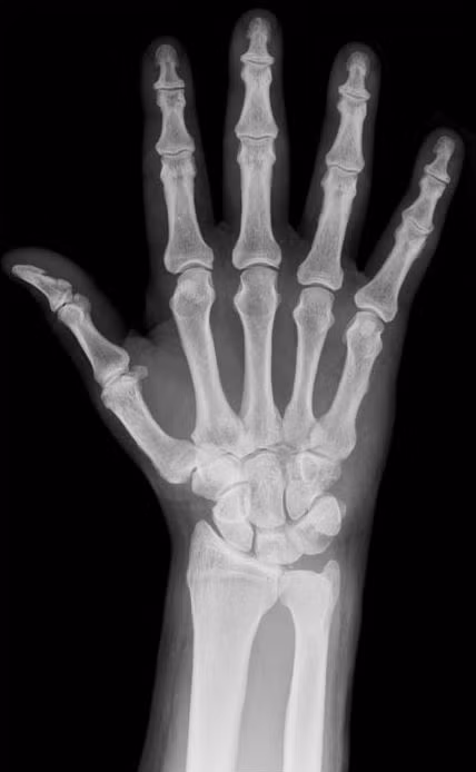 Nước chiếm 31% trong xương của con người. Đây là sự thực gây kinh ngạc cho nhiều người