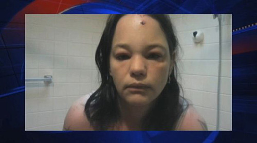 Bị tấn công vì ném tuyết vào mèo. Cuối năm 2013, một người phụ nữ vô cùng tức giận khi chú mèo Buddy đánh nhau với chú chó cưng của mình. Cô đã ném tuyết vào con mèo và ngay lập tức bị mèo tấn công lại. Nó đã cắn và cào xước mặt người phụ nữ này.