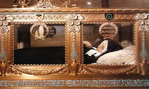 Bernadette là minh chứng rõ nhất cho hiện tượng xác Thánh không thối rữa đã được ghi nhận. Thánh Bernadette qua đời ở tuổi 30 và 30 năm sau đó, khi khai quật mộ, người ta vô cùng kinh ngạc khi thấy thi thể của bà vẫn còn nguyên vẹn.