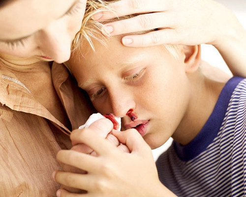 Tiếp đó, nghiêng đầu về trước một chút nhằm giúp phần máu cam chảy ra trước đó thoát ra ngoài thay vì chảy ngược vào trong.