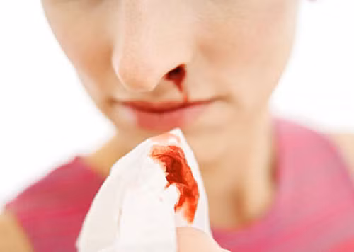 Việc giữ đầu ở tư thế ngẩng lên trời dễ khiến máu chảy xuống cổ họng. Thậm chí có trường hợp máu thâm nhập vào tai, mũi, họng rồi xuống phổi gây viêm nhiễm.