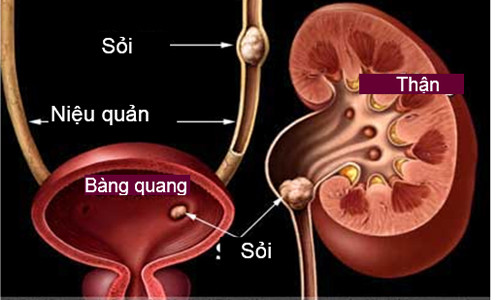 Một trong những lý do khiến tần suất đi tiểu của bạn tăng đột ngột là nhiễm khuẩn đường tiết niệu, phì tiền liệt tuyến. Tình trạng viêm nhiễm gây kích thích bàng quang và niệu đạo dẫn đến đi tiểu nhiều lần, tiểu không kiểm soát, tiểu ra máu. Lý giải điều này, các nhà khoa học tin rằng sự bất thường ở ống niệu đạo là nguyên nhân khiến bàng quang phải làm việc thường xuyên hơn nhằm đẩy nước thải ra ngoài.
