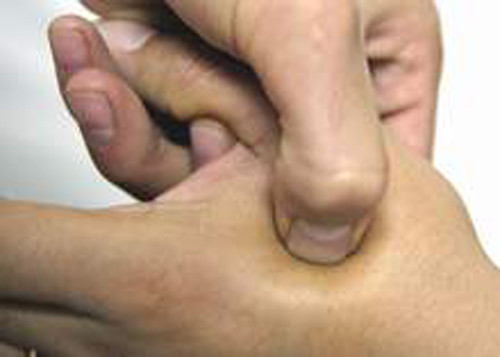 Bấm huyệt. Bấm huyệt là cách chữa chứng đau đầu hiệu quả, có thể dùng phổ biến với nhiều người khác nhau. Lúc này, bạn chỉ cần lấy tay day nhẹ phần da trên ngón tay trỏ và ngón tay cái là có thể giảm đau đầu.