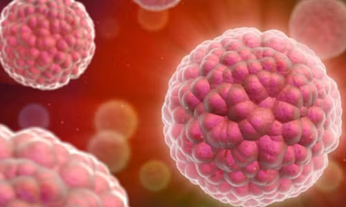 Thiéu nũ bị cát 4 xuong suòn vì chản doán ung thu sai