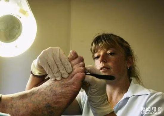 Nghề trị liệu chân ở Mỹ có tốc độ phát triển vô cùng nhanh chóng và có triển vọng cao. Nếu bạn bị chai chân, bầm móng chân hoặc bất kỳ bệnh nào khác liên quan tới chân, bạn có thể tới gặp họ bất cứ lúc nào. Mức lương của công việc này là 119.000 USD/năm (~2,7 tỷ đồng).