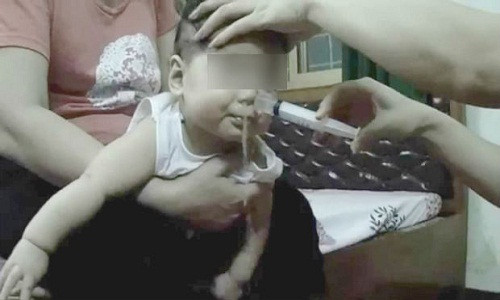 Dùng xilanh xịt rửa mũi của trẻ có thể gây viêm tai giữa. Ảnh: minh họa