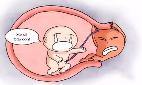 Me bau can kiem tra ngay khi co dau hieu nay