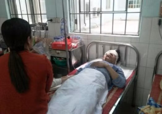 Hai Phong: Bon cong nhan bong nang khi lo nau phoi thep phat no-Hinh-2