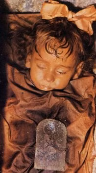 Rosalia Lambardo là em bé người Italy sinh năm 1918 ở Palermo, Sicily. Bé gái này qua đời vào ngày 6/12/1920 do viêm phổi. Cha của Roslia đau buồn trước cái chết của con gái nên ông nhờ giáo sư Alfredo Salafia - chuyên gia về ướp xác - bảo quản thi hài cô con gái nhỏ bé. Lambardo là một trong những thi hài cuối cùng được đặt vào trong hầm mộ Capuchin ở Palermo. Thi hài Lambardo là một trong những xác ướp được bảo quản tốt nhất thế giới, khiến không ít người không tin rằng cô bé đã qua đời cách đây khoảng 90 năm. Do vậy, xác ướp Lambardo được đặt cho biệt danh là "người đẹp ngủ".