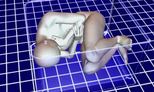 Thi thể người phụ nữ được đặt theo tư thế của bào thai trong vali. Cảnh sát xác định nạn nhân là Summer Baldwin và cô vẫn sống khi bị nhét vào vali. Summer chết vì ngạt thở. Người phụ nữ 29 tuổi là mẹ đơn thân của 4 con và đang mang thai 10 tuần.