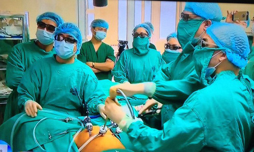 Ca phẫu thuật nội soi 3D cho một bệnh nhân mắc ung thư đại trực tràng tại bệnh viện K (Hà Nội) hồi tháng 3 vừa qua. Ảnh: Gia đình & Xã hội.