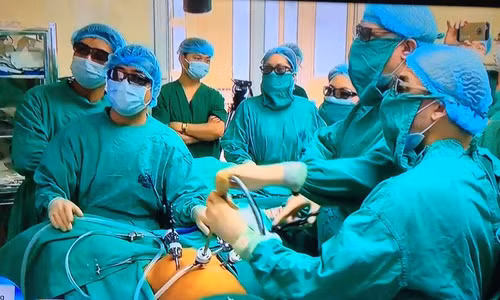 Ca phẫu thuật nội soi 3D cho một bệnh nhân mắc ung thư đại trực tràng tại bệnh viện K (Hà Nội) hồi tháng 3 vừa qua. Ảnh: Gia đình & Xã hội.