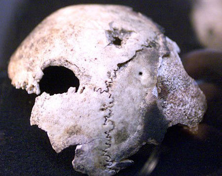 3. Vài tháng sau khi chiến tranh thế giới 2 kết thúc, cơ quan tình báo Liên Xô đã thu thập những đồ vật thuộc về Hitler, trong đó có mảnh xương sọ với một lỗ thủng do đạn xuyên qua ở bên ngoài hầm ngầm Fuhrer. Chúng được bảo quản tại Cục lưu trữ quốc gia Nga và trưng bày cho công chúng xem. Tuy nhiên, một số chuyên gia hoài nghi mảnh xương sọ không phù hợp với Hitler. Từ đó cho rằng Hitler đã không tự sát.