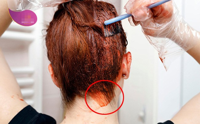 Bên cạnh cách chia tóc thành từng cụm nhỏ và quét thuốc thật khéo để tránh làm rơi rụng thuốc ra người và khắp nơi, thì chị em vẫn có thể "học lỏm" 1 tips nhỏ tránh thuốc dây lem nhem ra mang tai, trán với 1 mẹo nhỏ. Đó chính là thoa 1 lượng dầu xả quanh vị trí tiếp giáp giữa chân tóc và da. Dù thuốc nhuộm có dính vào thì bạn cũng sẽ dễ dàng lau sạch đi. Những vùng da như thế này thường "dính đạn" sau khi tóc lên màu. Vẫn sẽ tốt hơn nếu bạn nhờ được ai đó giúp sức trong quá trình chải thuốc lên tóc này.