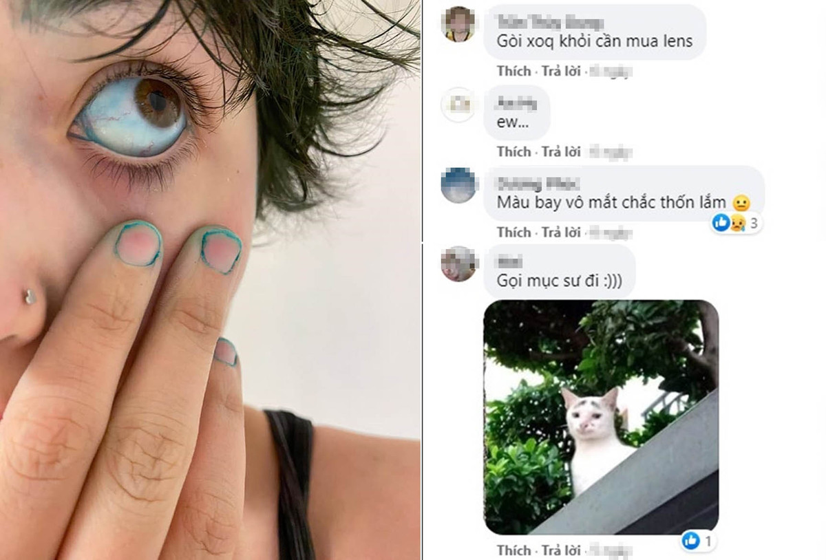 Mấy trường hợp thuốc nhuộm dính vào da trên kia còn thấy buồn cười chứ để thuốc dính vào cả mắt như này thì chỉ thấy sợ.