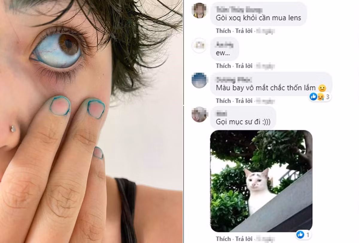 Mấy trường hợp thuốc nhuộm dính vào da trên kia còn thấy buồn cười chứ để thuốc dính vào cả mắt như này thì chỉ thấy sợ.