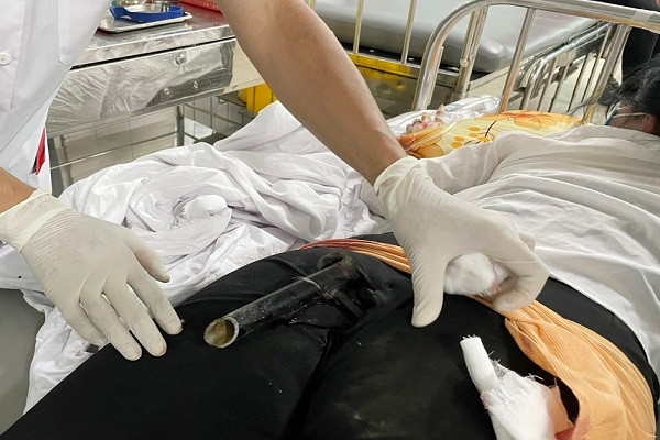 Cuu co gai bi chan chong xe dam vao mong