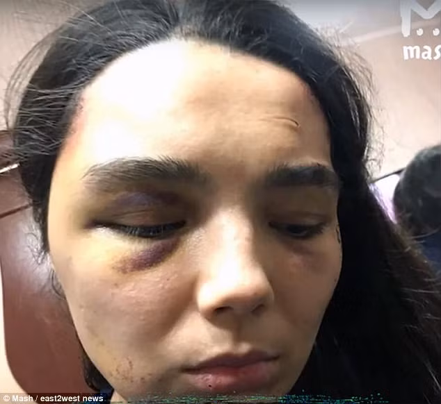 "Chúng tôi đã bị nhốt bên trong mọi lúc. Tôi không thể đi chơi ở bất cứ đâu. Con gái út của tôi chỉ được ra ngoài một lần", Lilia kể lại. Những đứa trẻ còn lại chỉ thỉnh thoảng được đưa ra ngoài.