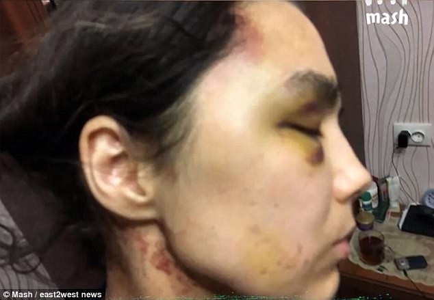 Riant cũng bị buộc tội đánh đập "vợ" của anh ta nhiều lần. "Anh ta đá tôi, đánh tôi bằng gậy", cô nói và chỉ vào những vết thương của mình.