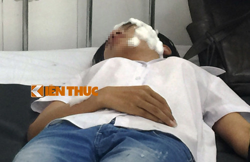 Mau thuan tinh ai, hai nu SV bi tat axit tren duong di hoc-Hinh-2