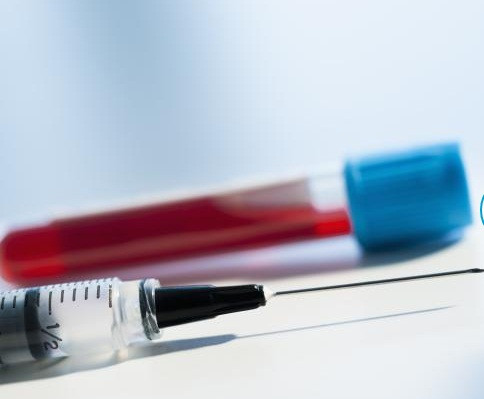 Bệnh mất trí do mắc HIV thường khiến bệnh nhân khó tập trung, trí nhớ giảm sút và có sự thay đổi về tính cách, hành vi.