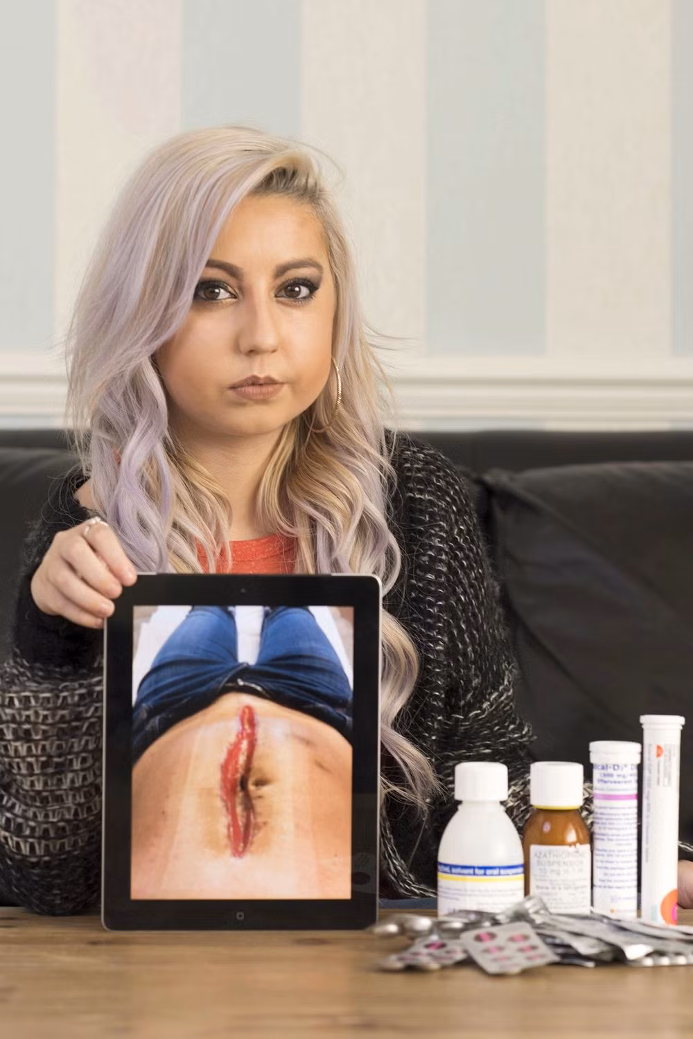 Cô phải điều trị bằng steroid, điều này khiến cơ thể giữ nước và các vết thương bắt đầu tách ra.