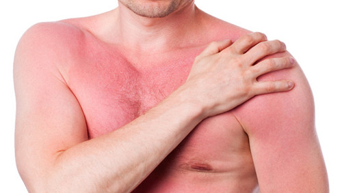 Một số trường hợp nặng sẽ làm nhịp tim của người bệnh tăng nhanh, sưng chân tay hoặc thân mình, đau bụng, tiêu chảy, buồn nôn, thậm chí gây bất tình hoặc khó thở cấp tính rất nguy hiểm tới tính mạng. Ảnh: thuocmatngu.com