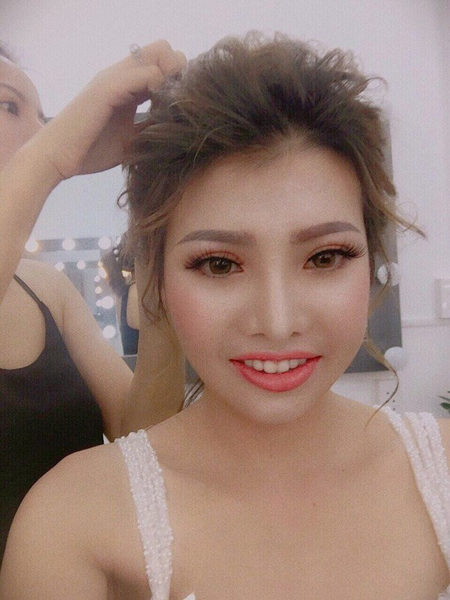 Để chấm dứt những tháng ngày sống trong mặc cảm bởi không may sở hữu nhan sắc xấu xí, Phượng đã hạ quyết tâm thực hiện hàng loạt các cuộc phẫu thuật thẩm mỹ bao gồm cắt hàm, hạ gò má, nhấn mí, nâng mũi.