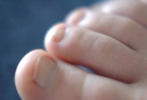 Trong sự nghiệp những người này chỉ bằng 2 bàn tay trắng cùng lòng quyết tâm hơn người, họ có thể làm nên cơ nghiệp của riêng mình, có được khối tài sản khổng lồ khiến bao người ngưỡng mộ và thèm muốn. Nếu phụ nữ sở hữu bàn chân với ngón cái lớn nhất trên bàn chân thì đây là tướng phụ nữ mang nhiều phúc khí. Người này cuộc đời hạnh phúc viên mãn.