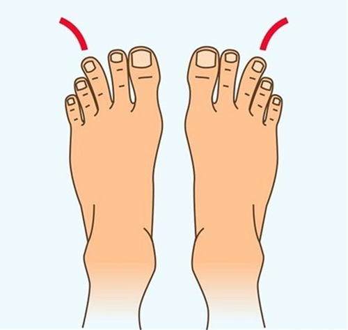 Ngón chân thứ 3 dài nhất. Trong nhân tướng học nếu bạn là người có sở hữu ngón chân thứ 3 dài nhất trên cả bàn chân thì đây là người trời sinh có vận mệnh bất phàm. Trong cuộc sống thì phần lớn những người này trong tính cách người có tướng bàn chân với ngón thứ 3 dài nhất cực kỳ mạnh mẽ, kiên cường. Những người này họ vô cùng hạnh phúc dễ làm nên sự nghiệp lớn. 