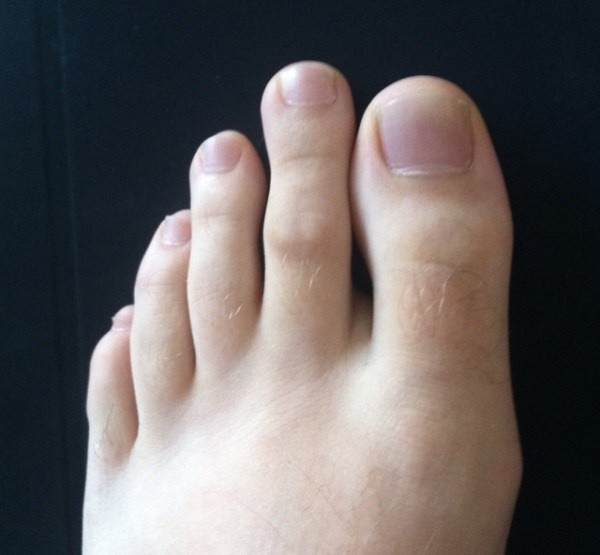 Nam giới nếu như sở hữu tướng bàn chân với ngón trỏ dài nhất thì vận mệnh thì tham vọng cực lớn, luôn đặt sự nghiệp lên hàng đầu, không thích cuộc sống an nhàn, ổn định mà thích sự thử thách. Trong sự nghiệp những người này họ không dễ dàng khuất phục trước khó khăn, luôn giữ cho mình tinh thần đấu tranh bất khuất kiên cường, đạt được mục đích mới thôi.