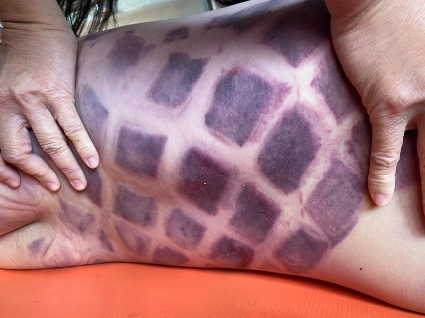 Vu chau be nguoi Nhat tu vong o ho boi: Da co ket luan giam dinh-Hinh-2