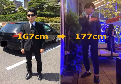 Muon dep hon, chang trai chap nhan dap gay chan gay soc