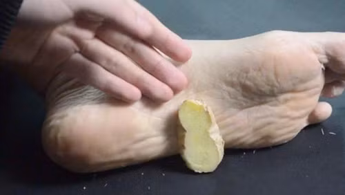 Xat gung vao 2 diem tren co the moi toi, tac dung kinh ngac