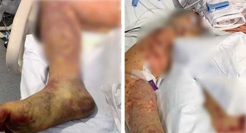 An mi ga kieu nay, nam sinh phai cat cut ca hai chan