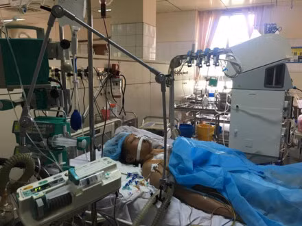 Benh nhan nang trong su co chay than dang dien bien xau