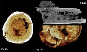 Xương là một trong những mô ít bị phân hủy, giúp các nhà khoa học tìm ra dấu vết của ung thư trong hóa thạch.