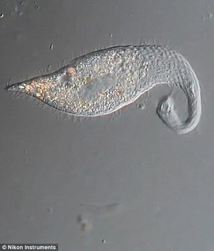 Thức ăn của loài sinh vật kỳ lạ này là các vi sinh vật nhỏ hơn như ciliates, trùng roi và amip.