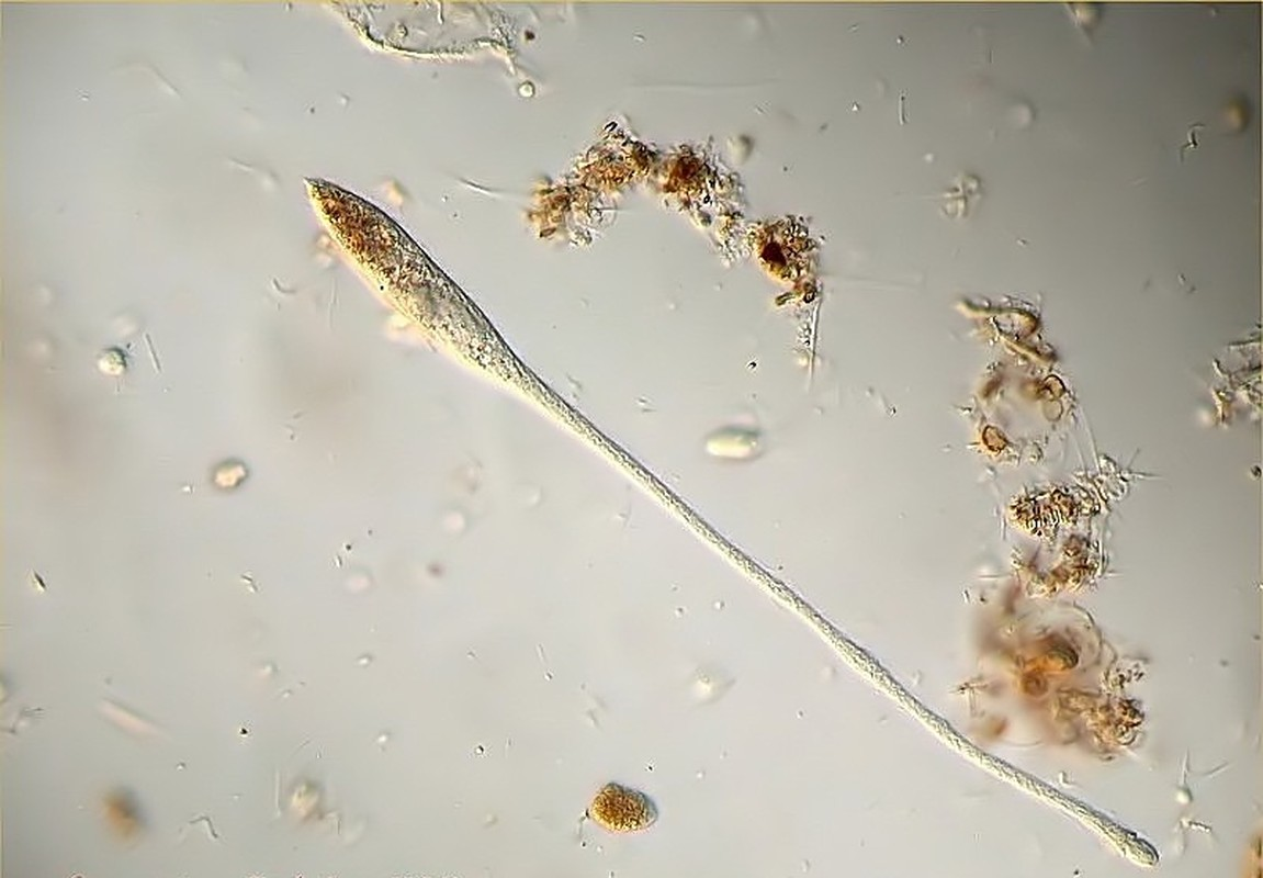 Đồng thời, loài sinh vật nguyên sinh này cũng có thể sinh sản vô tính sau khi tự sắp xếp lại gen nội bộ của mình.