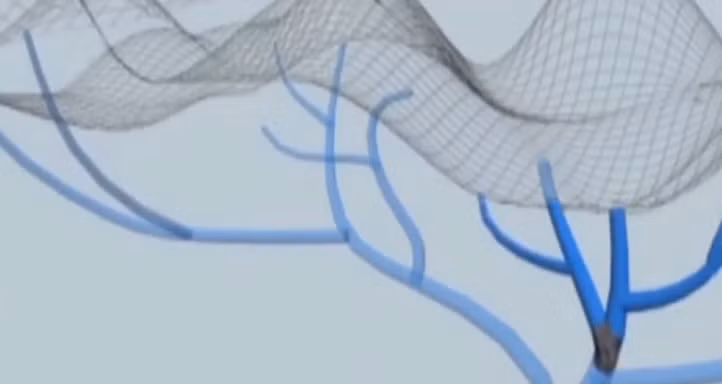 Khi các điểm tắc nghẽn trong hệ thống này được thông, nước hồ chảy vào các nhánh khác và biến mất nhanh chóng.