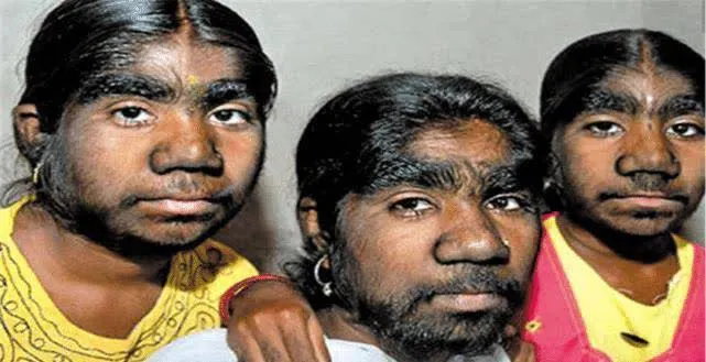 Các cư dân này đều có các đặc điểm giống nhau như mũi hình nón, lông mày rậm và môi dày, khiến việc phân biệt trở nên khó khăn.