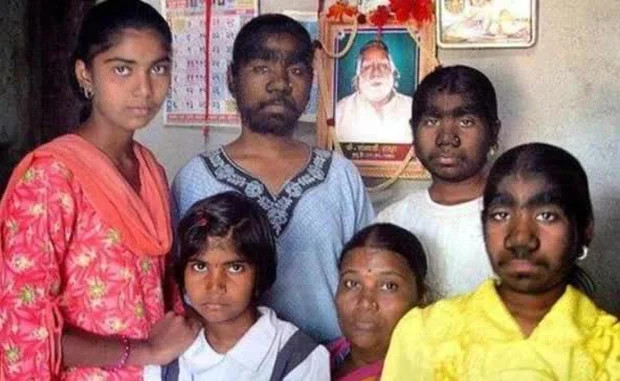 Tại ngôi làng Haragonan ở phía Nam Ấn Độ, có hơn 200 cư dân có ngoại hình giống hệt nhau dù không cùng huyết thống, gây kinh ngạc và thách thức giới khoa học.