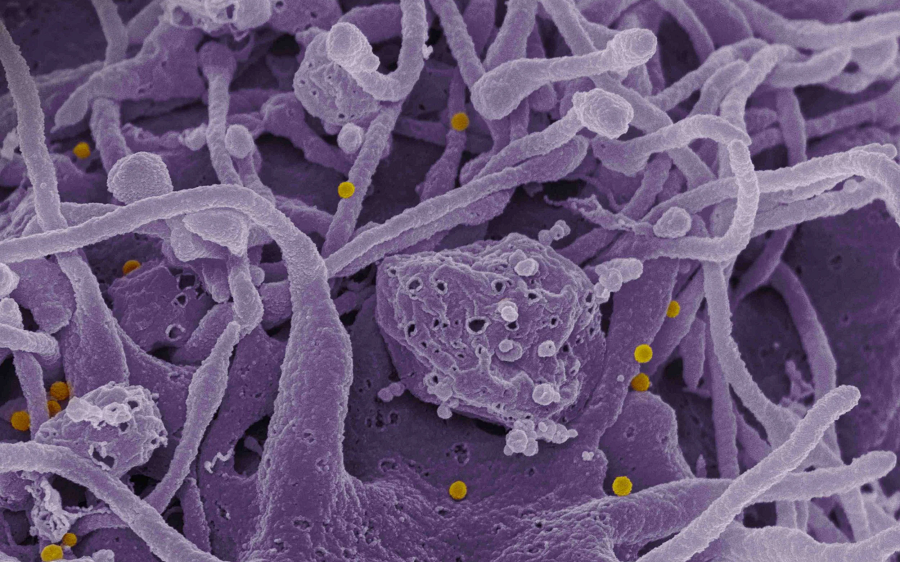 7. Virus sốt Crimea-Congo: Virus này lây lan qua động vật trung gian là các con Pet, với các triệu chứng xuất huyết ở mặt, miệng và họng trong những ngày đầu nhiễm trùng. Nó tương tự như virus Ebola và Marburg về quá trình phát triển bệnh.