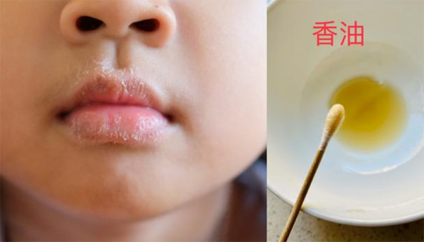 Thay vào đó, bạn có thể dùng dầu mè để bôi cho con sẽ an toàn hơn. Khi thực hiện, mẹ dùng tăm bông thấm một lớp dầu mỏng, nhẹ nhàng thoa đều khắp bề mặt môi. Dầu mè có tác dụng dưỡng ẩm, không lo trẻ “ăn” hóa chất khi liếm.